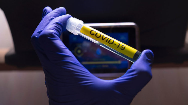 Initiative Covax - Vers la fourniture de 40 millions de doses de vaccin contre le Covid-19